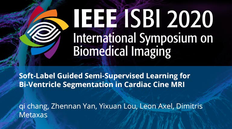 Soft-Label Guided Semi-Supervised Learning for Bi-Ventricle Segmentation in Cardiac Cine MRI