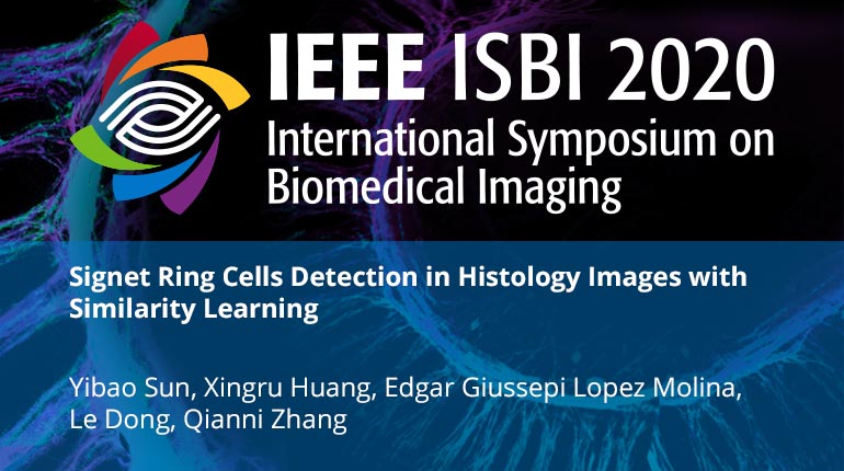 Signet Ring Cells Detection in Histology Images with Similarity Learning