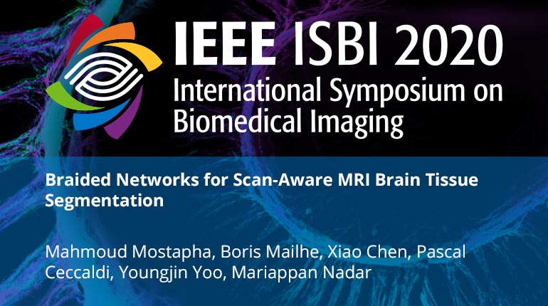 Braided Networks for Scan-Aware MRI Brain Tissue Segmentation