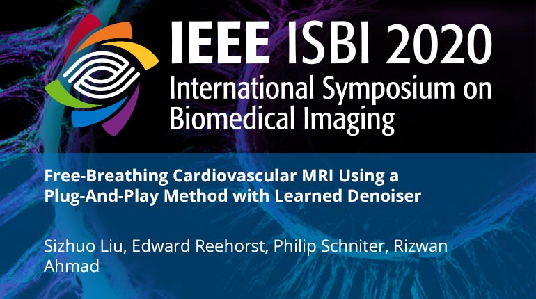 Free-Breathing Cardiovascular MRI Using a Plug-And-Play Method with Learned Denoiser