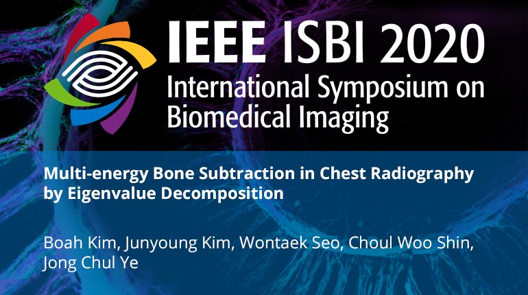 Multi-energy Bone Subtraction in Chest Radiography by Eigenvalue Decomposition