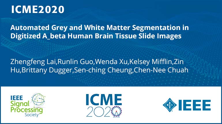 Automated Grey and White Matter Segmentation in Digitized A_beta Human Brain Tissue Slide Images