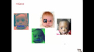 How Facial Analysis Technology Can Help Children with Genetic Disorders - IEEE Region 4 Technical Presentation