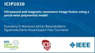 Ultrasound and magnetic resonance image fusion using a patch-wise polynomial model